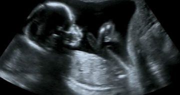 Majority of Catholics No Longer Believe Abortion Is "Intrinsically Evil"